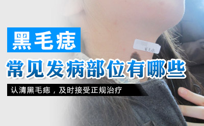 江苏激光去胎记医院哪家较好