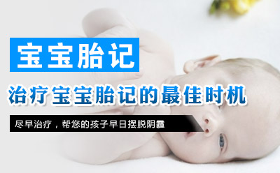 发现孩子患有宝宝胎记怎么办